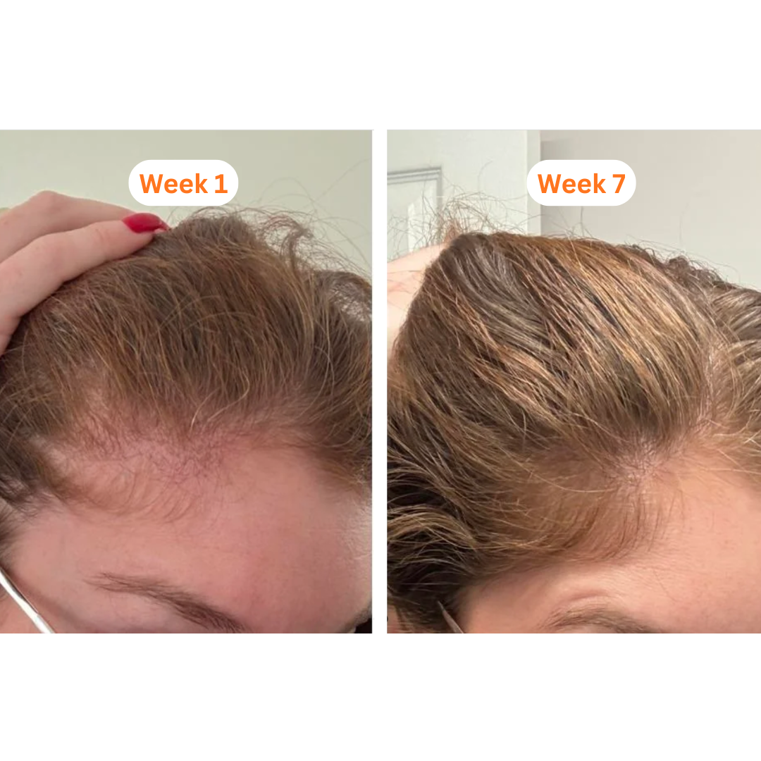 LunaLee™ GrowTurn Hair Brush Serum