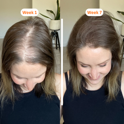 LunaLee™ GrowTurn Hair Brush Serum