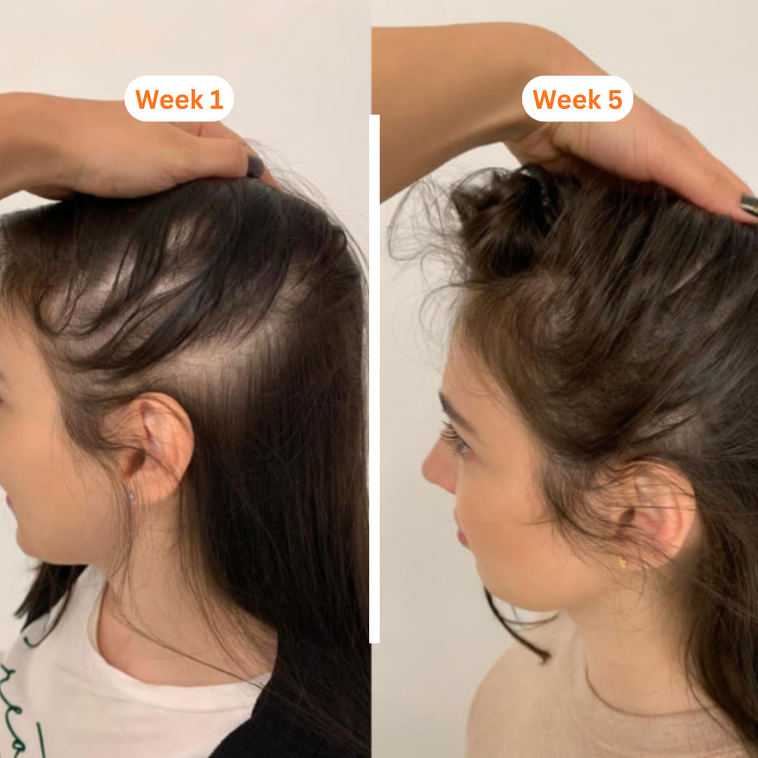 LunaLee™ GrowTurn Hair Brush Serum