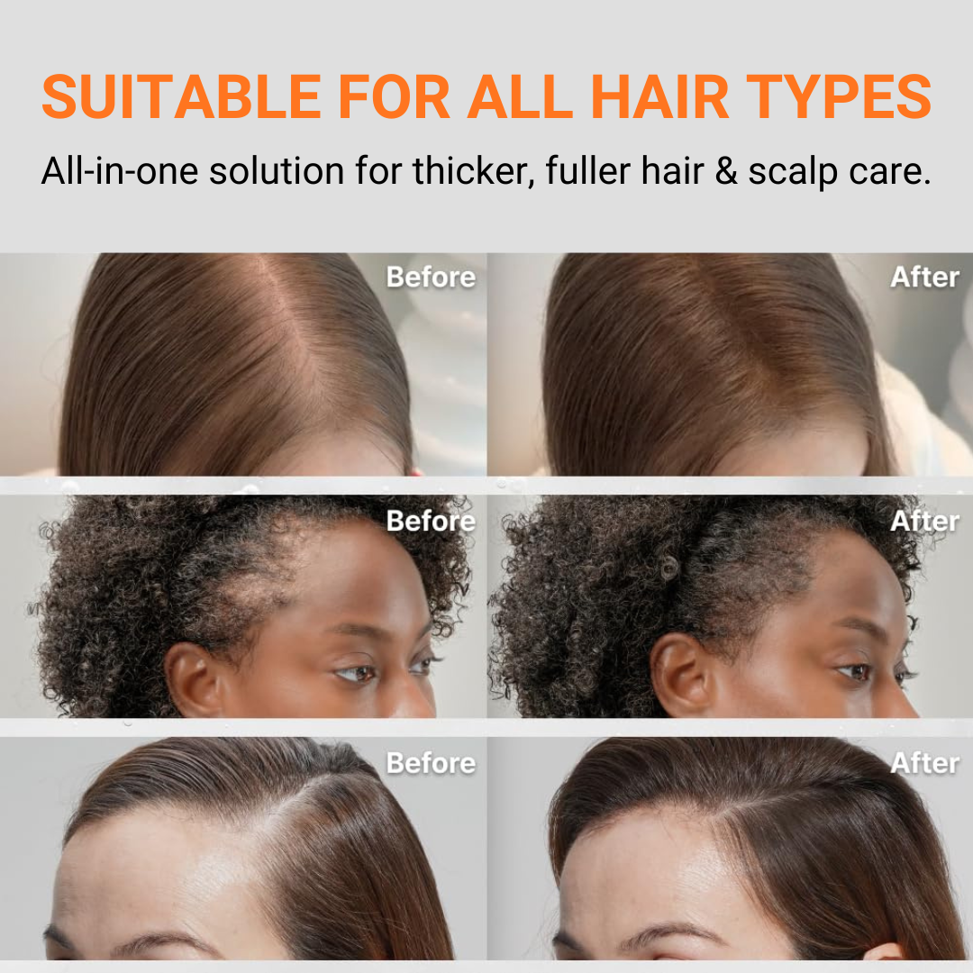 LunaLee™ GrowTurn Hair Brush Serum