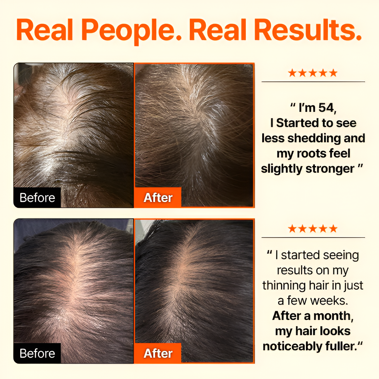 LunaLee™ GrowTurn Hair Brush Serum