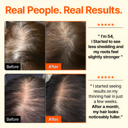 LunaLee™ GrowTurn Hair Brush Serum